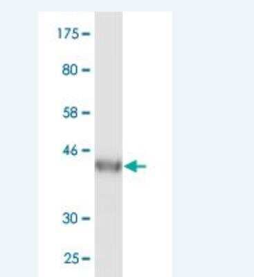 Western Blot: VPS25 Antibody (4D6-2D4) [H00084313-M02]