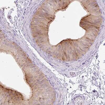 Immunohistochemistry-Paraffin: VPS25 Antibody [NBP2-33824]