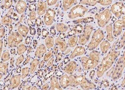 Immunohistochemistry-Paraffin: VPS25 Antibody [NBP3-06483]