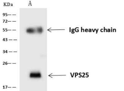 Immunoprecipitation: VPS25 Antibody [NBP3-06483]