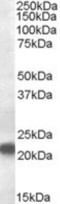 Western Blot: VPS25 Antibody [NB100-2468]