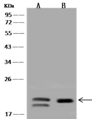 Western Blot: VPS25 Antibody [NBP3-06483]