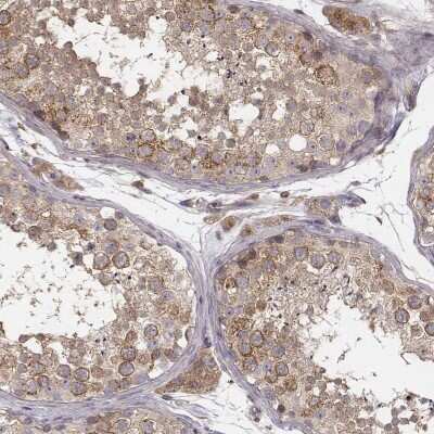 Immunohistochemistry-Paraffin: VPS26A Antibody [NBP2-49257]