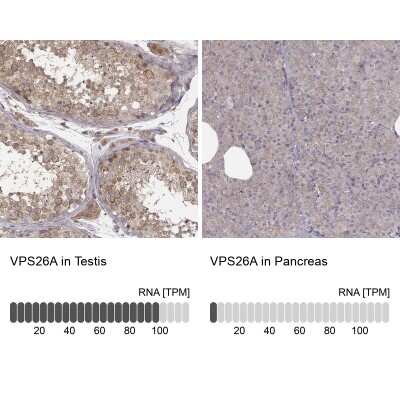 Immunohistochemistry-Paraffin: VPS26A Antibody [NBP2-49257]