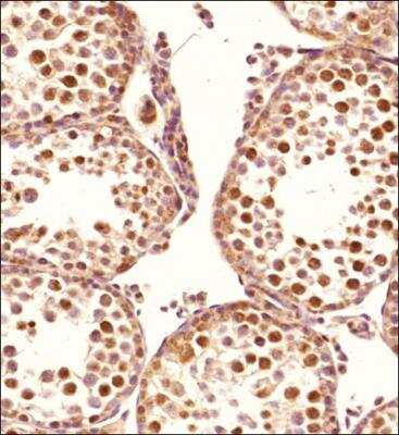 Immunohistochemistry-Paraffin: VPS26A Antibody - BSA Free [NBP2-75922]