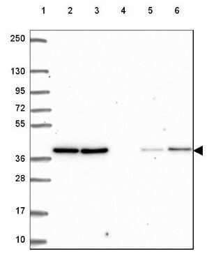 Western Blot: VPS26A Antibody [NBP2-49257]