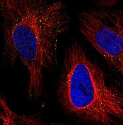 Immunocytochemistry/ Immunofluorescence: VPS26A Antibody (CL2287) [NBP2-36754]
