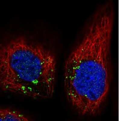Immunocytochemistry/ Immunofluorescence: VPS26A Antibody (CL2287) [NBP2-36754]