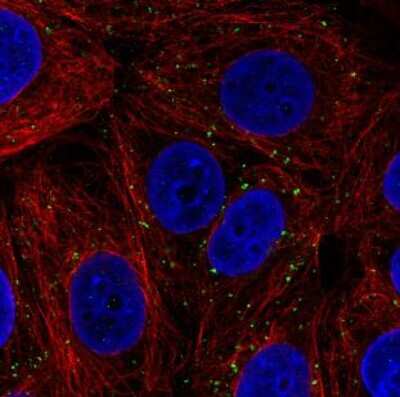 Immunocytochemistry/ Immunofluorescence: VPS26A Antibody (CL2287) [NBP2-36754]