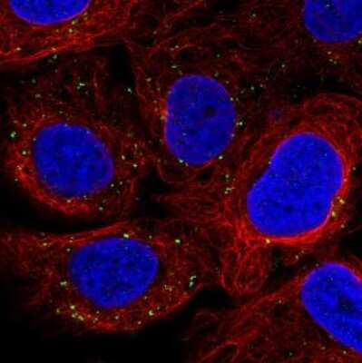 Immunocytochemistry/ Immunofluorescence: VPS26A Antibody (CL2287) [NBP2-36754]