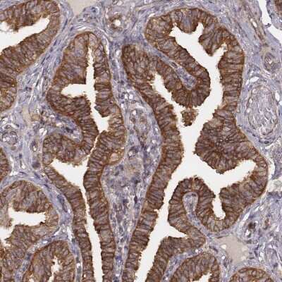 Immunohistochemistry-Paraffin: VPS26A Antibody (CL2287) [NBP2-36754]