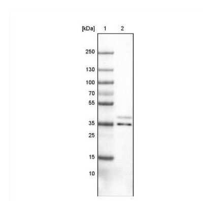 Western Blot: VPS26A Antibody (CL2287) [NBP2-36754]