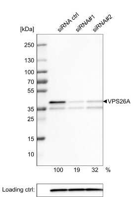 Western Blot: VPS26A Antibody (CL2287) [NBP2-36754]