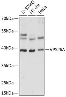 Western Blot: VPS26A AntibodyAzide and BSA Free [NBP2-93897]