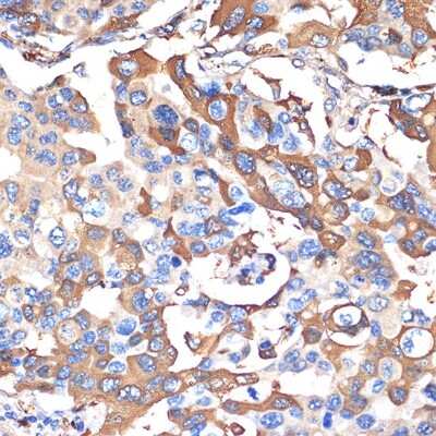 Immunohistochemistry-Paraffin: VPS28 Antibody (4F8M0) [NBP3-15703]
