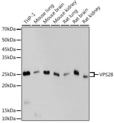 Western Blot: VPS28 Antibody (4F8M0) [NBP3-15703]