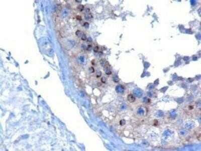 Immunohistochemistry-Paraffin: VPS28 Antibody [NB100-1399]