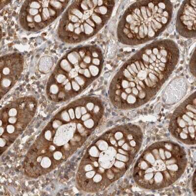 Immunohistochemistry-Paraffin: VPS28 Antibody [NBP1-85976]