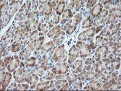 Immunohistochemistry: VPS28 Antibody (OTI1A8) - Azide and BSA Free [NBP2-74854]