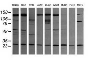 Western Blot: VPS28 Antibody (OTI1A8)Azide and BSA Free [NBP2-74854]