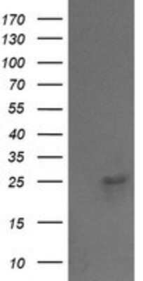 Western Blot: VPS28 Antibody (OTI1A8)Azide and BSA Free [NBP2-74854]