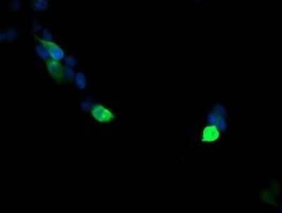 Immunofluorescence: VPS28 Antibody (OTI1A8) [NBP2-45412]