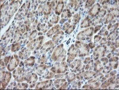 Immunohistochemistry: VPS28 Antibody (OTI1A8) [NBP2-45412]