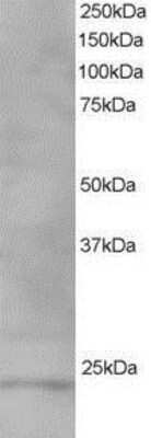 Western Blot: VPS28 Antibody [NB100-1399]