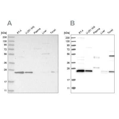 Western Blot: VPS28 Antibody [NBP1-85973]