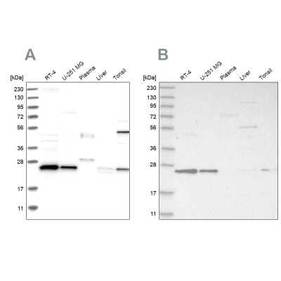 Western Blot: VPS28 Antibody [NBP1-85976]