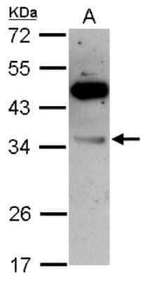 Western Blot: VPS28 Antibody [NBP2-20870]