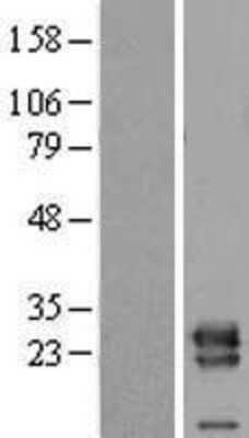 Western Blot: VPS28 Overexpression Lysate [NBL1-17742]