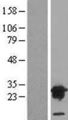 Western Blot: VPS28 Overexpression Lysate [NBL1-17743]