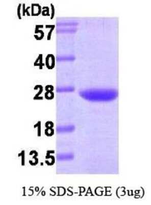SDS-PAGE: Recombinant Human VPS28 Protein [NBP1-30248]