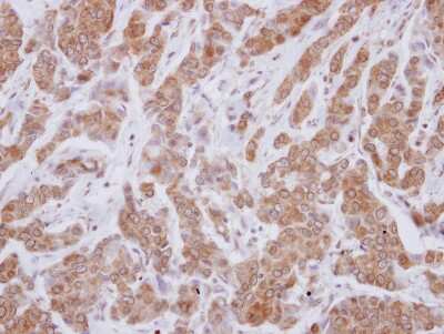 Immunohistochemistry-Paraffin: VPS29 Antibody [NBP2-20871]