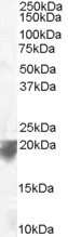 Western Blot: VPS29 Antibody [NB100-1387]