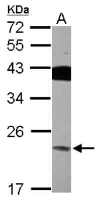 Western Blot: VPS29 Antibody [NBP2-20871]