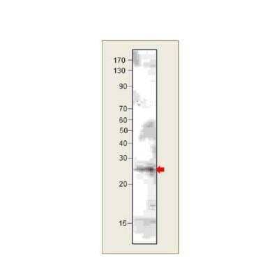 Western Blot: VPS29 Antibody [NBP3-12366]