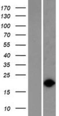 Western Blot: VPS29 Overexpression Lysate [NBP2-05800]