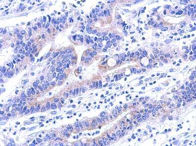 Immunohistochemistry-Paraffin: VPS33A Antibody [NBP2-20872]