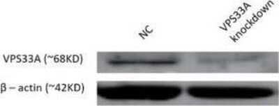 Knockdown Validated: VPS33A Antibody [NBP2-20872]
