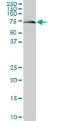 Western Blot: VPS33A Antibody [H00065082-B01P]