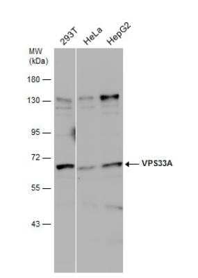 Western Blot: VPS33A Antibody [NBP2-20872]