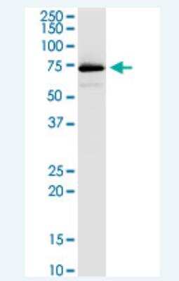 Western Blot: VPS33B Antibody (3E11) [H00026276-M01-100ug]