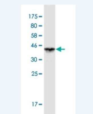 Western Blot: VPS33B Antibody (3E11) [H00026276-M01-100ug]