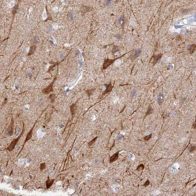 Immunohistochemistry-Paraffin: VPS33B Antibody [NBP1-82220]