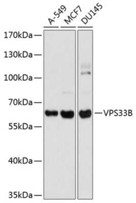 Western Blot: VPS33B AntibodyBSA Free [NBP2-94816]