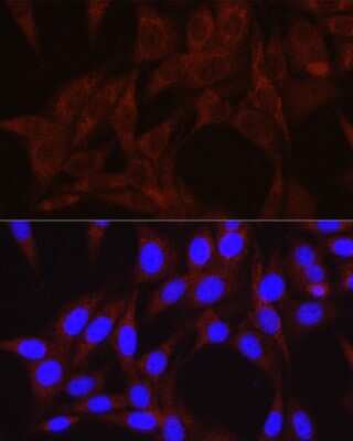 Immunocytochemistry/ Immunofluorescence: VPS34 Antibody - Azide and BSA Free [NBP2-94087]