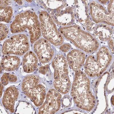 Immunohistochemistry-Paraffin: VPS34 Antibody [NBP1-86862]
