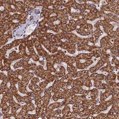 Immunohistochemistry-Paraffin: VPS34 Antibody [NBP1-86862]